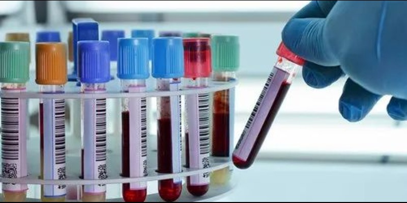 Hematology Instruments and Reagents Market - Analysis & Consulting (2024-2030)