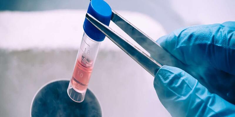 Mesenchymal Stem Cells (MSC) Market - Analysis & Consulting(2024-2030)